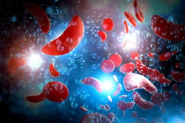 Anemia: Cauze, simptome și modalități de tratament